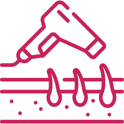 αποτρίχωση